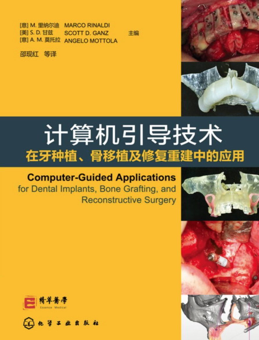 COMPUTER-GUIDED APPLICATIONS Chinese version