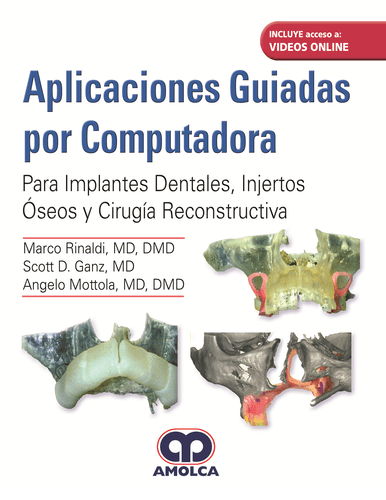COMPUTER-GUIDED APPLICATIONS spanish version