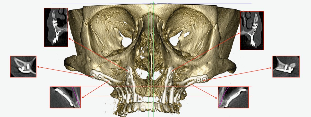 Controllo a 5y AMSJI