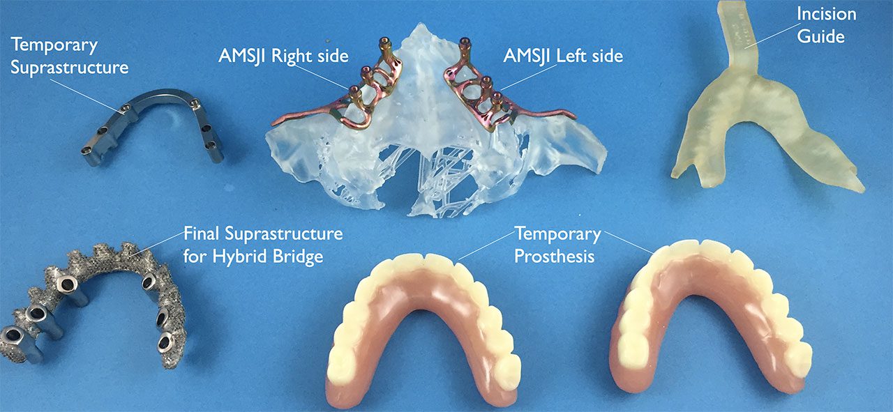 Componenti per impianto AMSJI